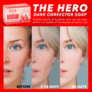 Koji White – Kojic Acid Dunkle-Flecken-Korrektur Seife