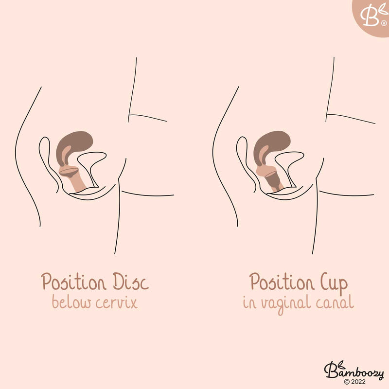 Diagramm, das die korrekten Positionen für eine Menstruationsscheibe (unterhalb des Gebärmutterhalses) und eine Menstruationstasse (im Vaginalkanal) innerhalb der weiblichen Anatomie zeigt.