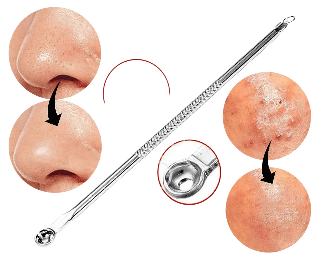 Glamza doppelseitiges Gesichtswerkzeug zur Entfernung von Mitessern, Akne und Pickeln, langlebig und bequem in der Handhabung