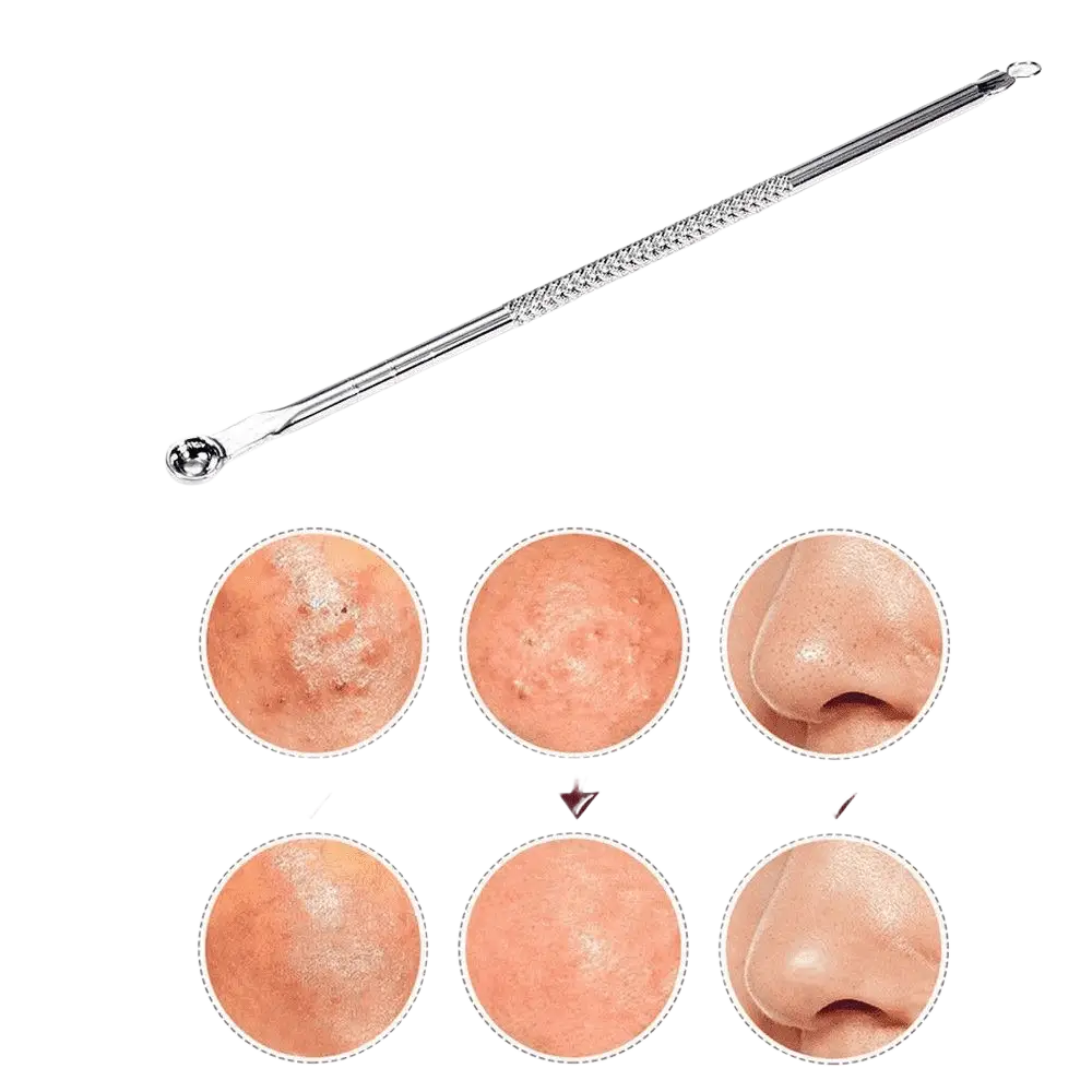 Glamza doppelseitiges Werkzeug zur Entfernung von Mitessern, Akne und Pickeln, für die Gesichtsreinigung, von My Wholesale Warehouse