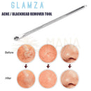 Silberfarbenes glamza doppelseitiges werkzeug aus edelstahl mit strukturierter grifffläche für effektive mitesserentfernung bei manashop