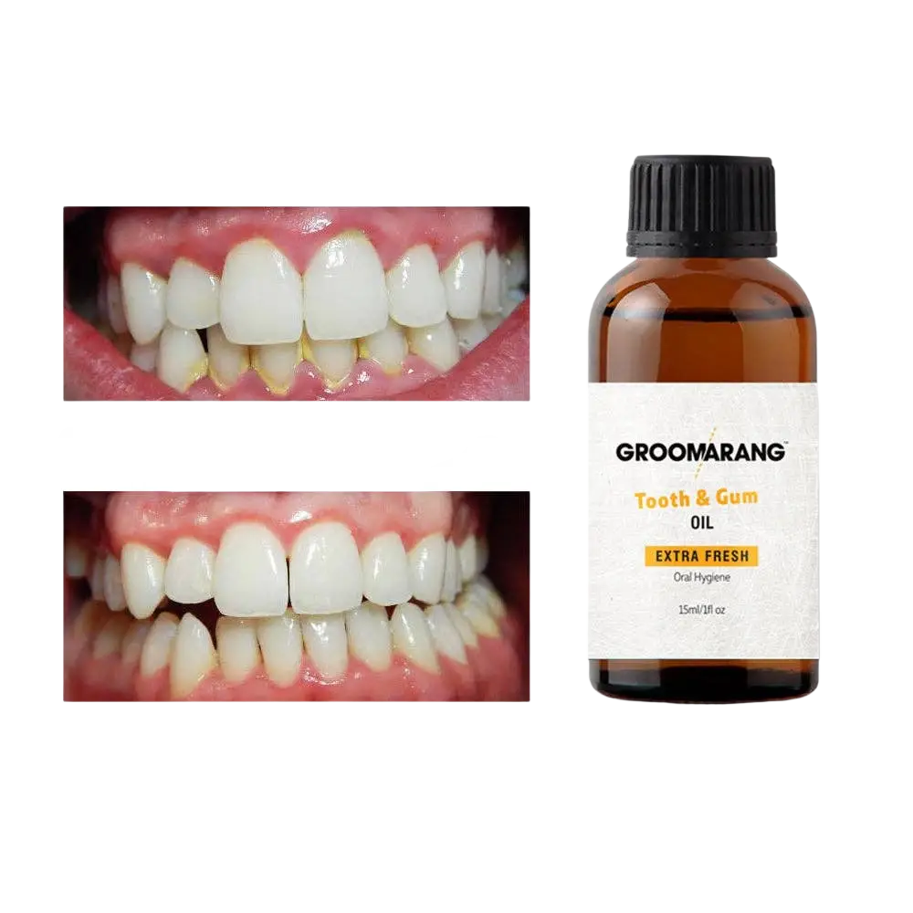 Groomarang Extra Strength Zahn- und Zahnfleischpflegeöl in 15 ml Flasche, für gesunde Zähne und Zahnfleisch, von My Wholesale Warehouse