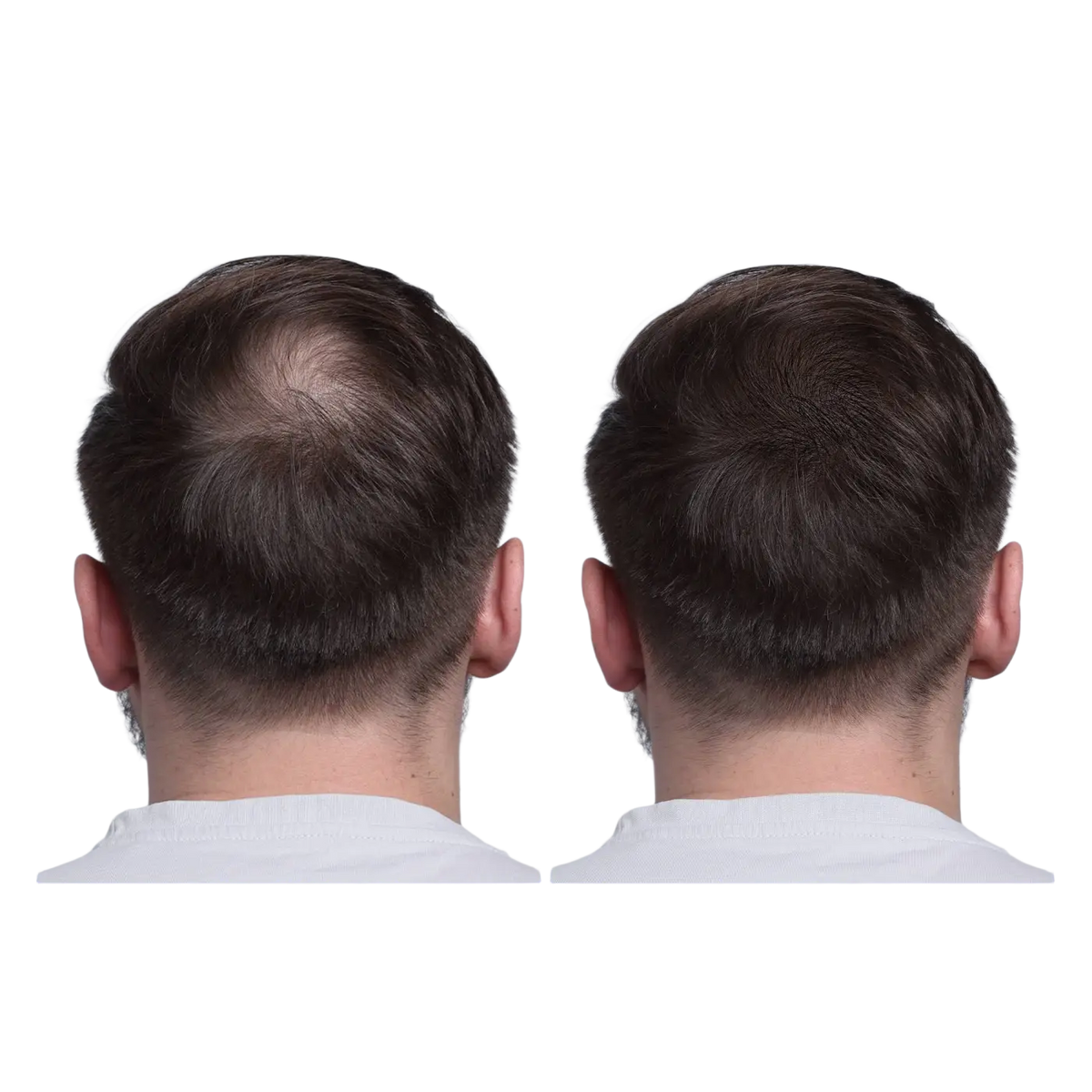 HARMONIFY Schwarzer Reiswasser Spray für Haare, veganes Haarserum gegen Haarausfall, Spliss und dünner werdendes Haar