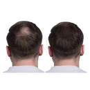 Image von dunkelbraunen kurzen haaren mit vollem oberkopf und gepflegten seiten, harmonify schwarzer reiswasser spray gegen haarausfall und spliss