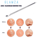 Glamza doppelseitiges Werkzeug zur Mitesser- und Akneentfernung, Gesichtspflege, von My Wholesale Warehouse, aus Edelstahl