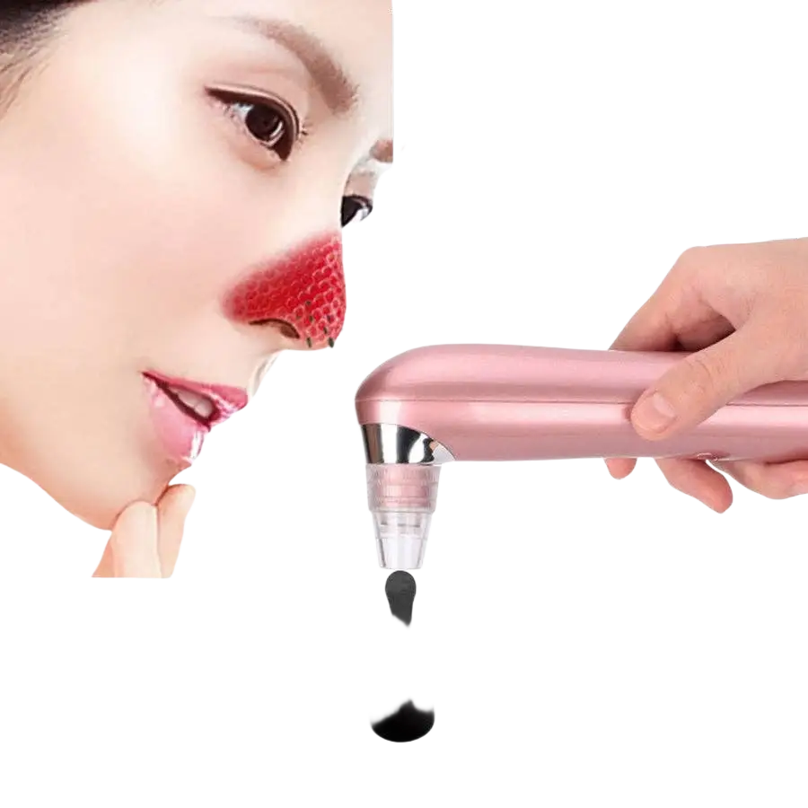 Porenreinigender Gesichtsreiniger für Mitesser, Pickel und Akne, pinkes Design, von My Wholesale Warehouse.